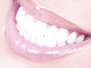 Detailbild: Ästhetische Zahnheilkunde - Bleaching