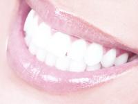 Foto: Ästhetische Zahnheilkunde - Bleaching